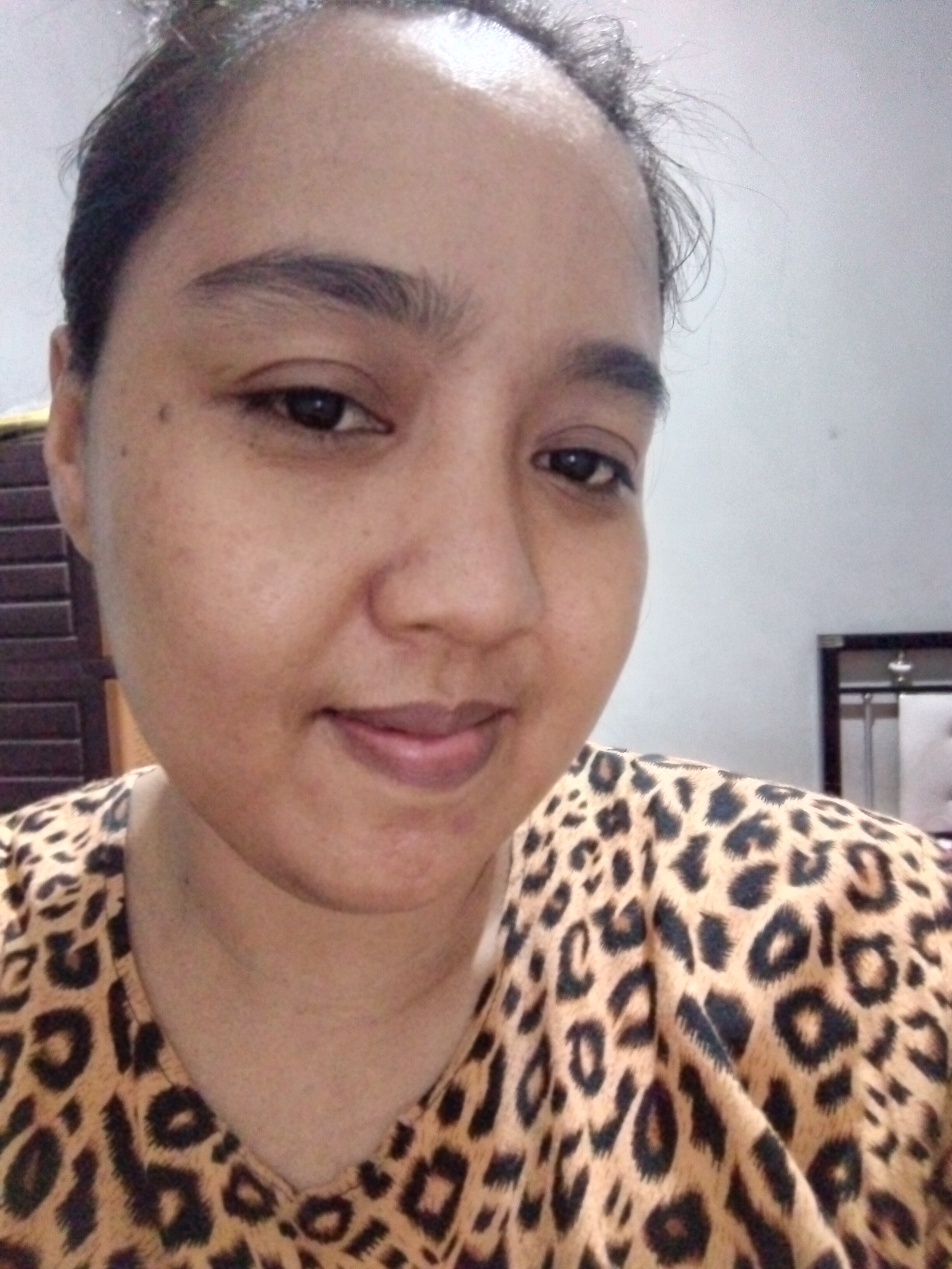 Mengapa Kulit Saya Kelihatan Kusam Walaupun Selepas Pengelupasan?