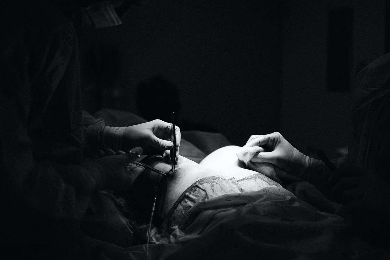Breast-augmentation.jpg