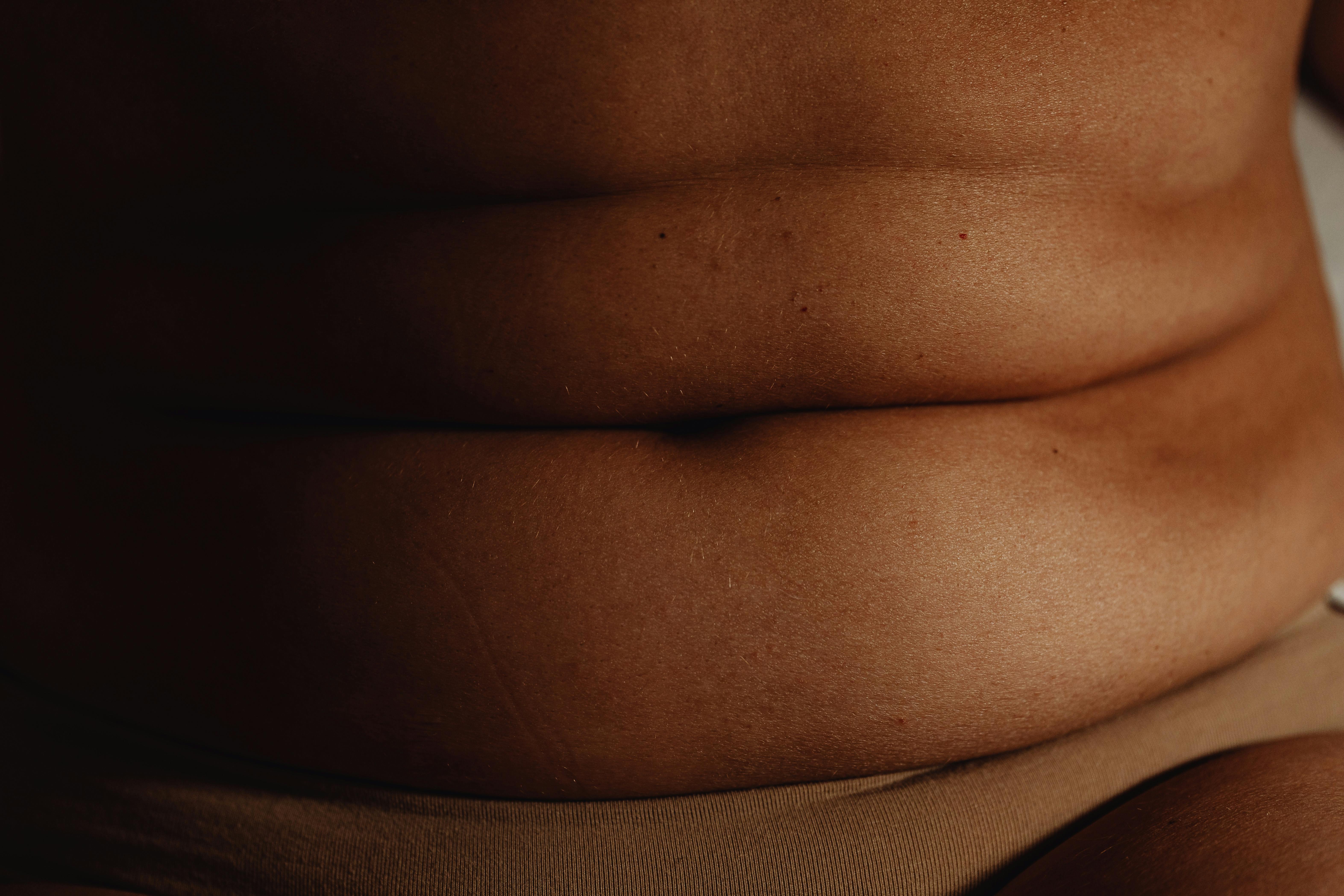 Obesity.jpg