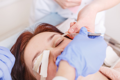 Blepharoplasty.jpg